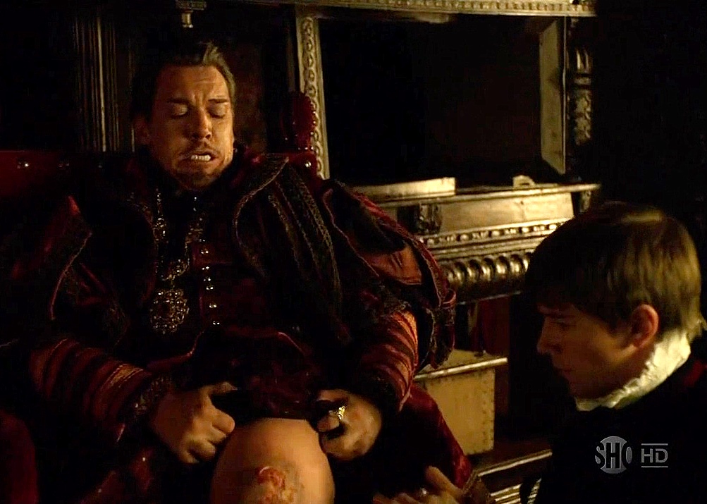 JRM as King Henry VIII with Culpepper tending his wound